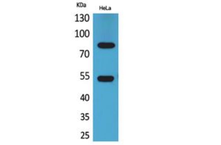 Western blot - IFN-γRα Polyclonal Antibody from Signalway Antibody (41780) - Antibodies.com