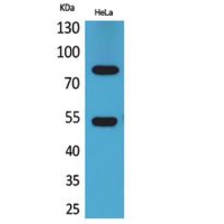 Western blot - IFN-γRα Polyclonal Antibody from Signalway Antibody (41780) - Antibodies.com