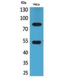Western blot - IFN-γRα Polyclonal Antibody from Signalway Antibody (41780) - Antibodies.com