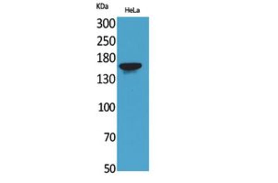 Western blot - Jagged1 Polyclonal Antibody from Signalway Antibody (41786) - Antibodies.com
