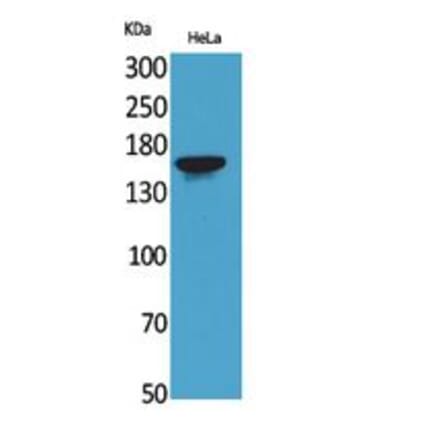 Western blot - Jagged1 Polyclonal Antibody from Signalway Antibody (41786) - Antibodies.com