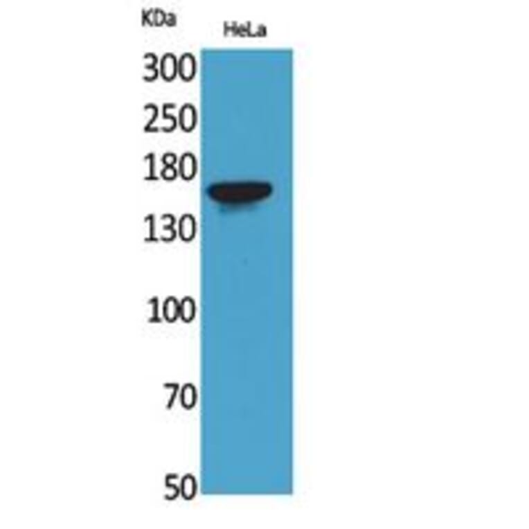 Western blot - Jagged1 Polyclonal Antibody from Signalway Antibody (41786) - Antibodies.com