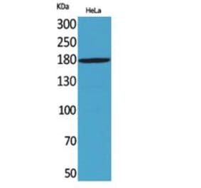 Western blot - Endo180 Polyclonal Antibody from Signalway Antibody (41788) - Antibodies.com