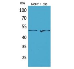 Western blot - PD-ECGF Polyclonal Antibody from Signalway Antibody (41799) - Antibodies.com