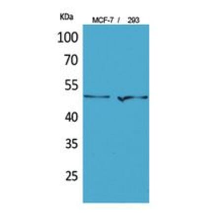 Western blot - PD-ECGF Polyclonal Antibody from Signalway Antibody (41799) - Antibodies.com
