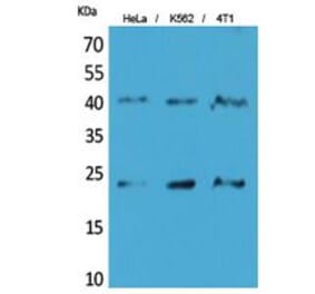 Western blot - TMEM173 Polyclonal Antibody from Signalway Antibody (41859) - Antibodies.com
