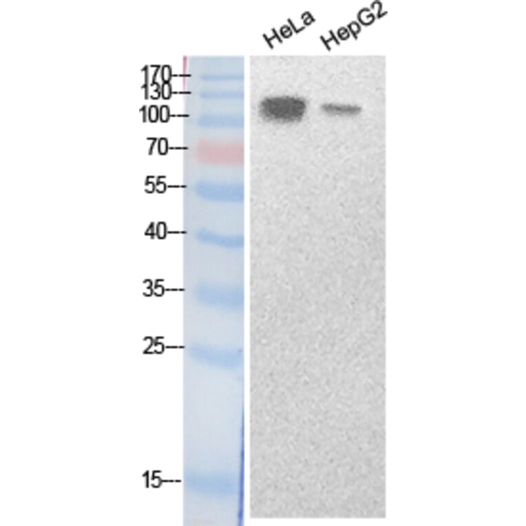 Western blot - SREBP-1 Polyclonal Antibody from Signalway Antibody (41878) - Antibodies.com