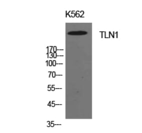Western blot - Talin-1 Polyclonal Antibody from Signalway Antibody (41942) - Antibodies.com