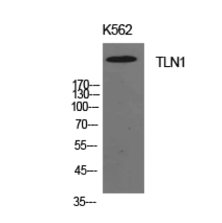 Western blot - Talin-1 Polyclonal Antibody from Signalway Antibody (41942) - Antibodies.com