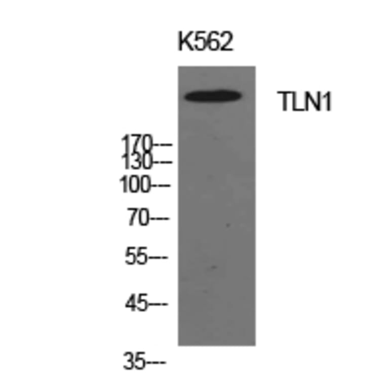 Western blot - Talin-1 Polyclonal Antibody from Signalway Antibody (41942) - Antibodies.com