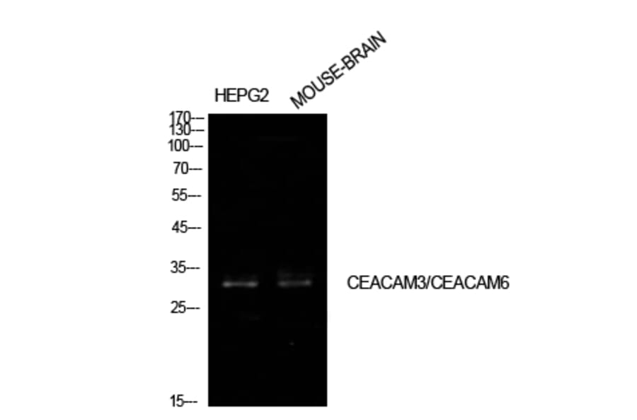 Western blot - CD66c/d Polyclonal Antibody from Signalway Antibody (41959) - Antibodies.com