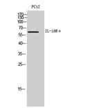 Western blot - IL-10Rα Polyclonal Antibody from Signalway Antibody (41994) - Antibodies.com