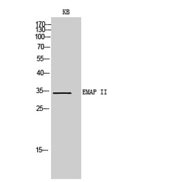 Western blot - EMAP II Polyclonal Antibody from Signalway Antibody (42007) - Antibodies.com