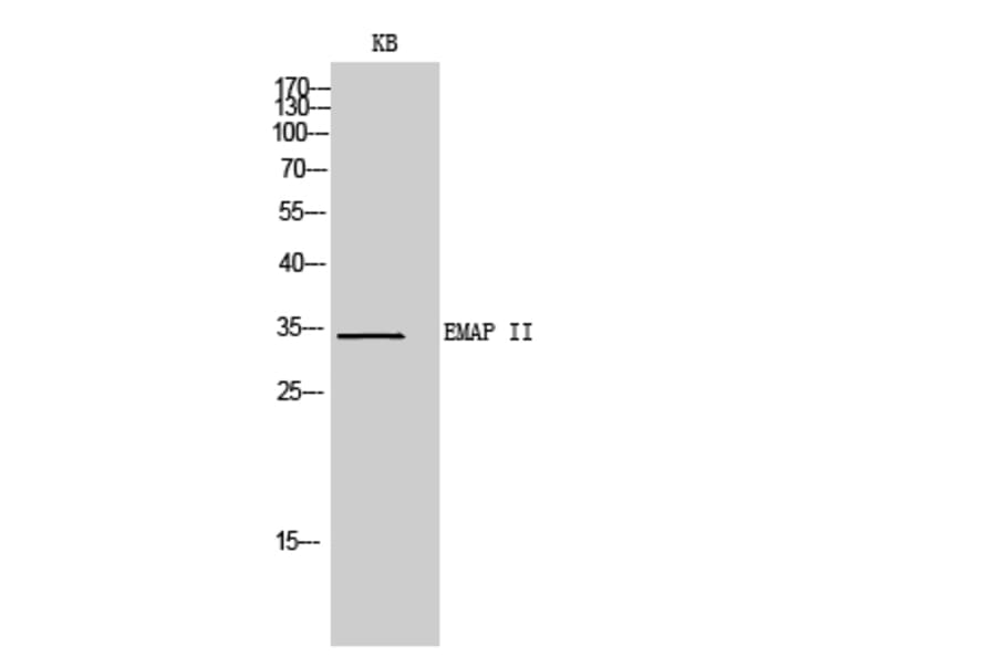 Western blot - EMAP II Polyclonal Antibody from Signalway Antibody (42007) - Antibodies.com