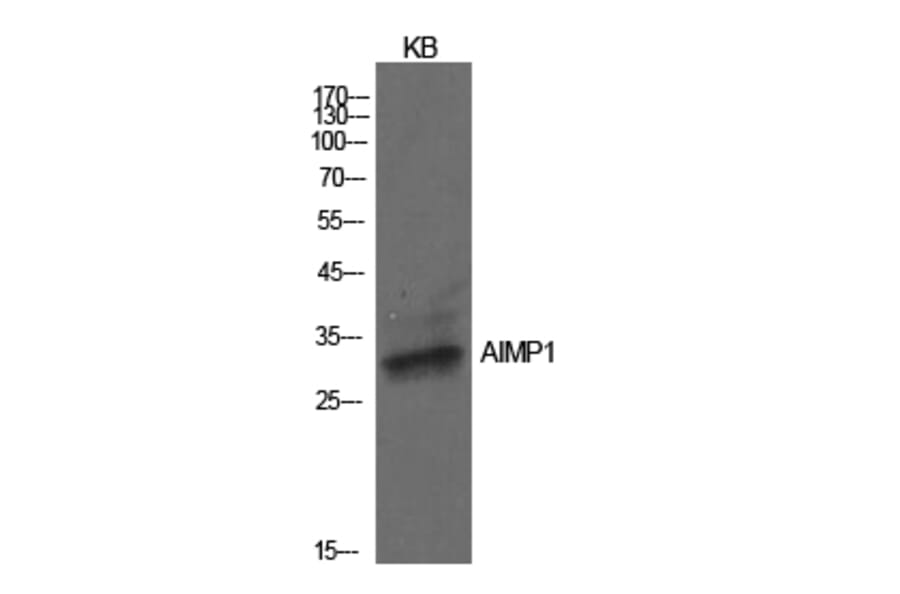 Western blot - EMAP II Polyclonal Antibody from Signalway Antibody (42007) - Antibodies.com