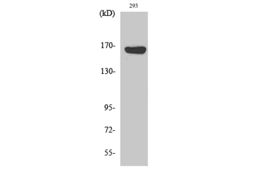 Western blot - ABCC12 Polyclonal Antibody from Signalway Antibody (40533) - Antibodies.com