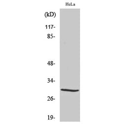 Western blot - Acrp30 Polyclonal Antibody from Signalway Antibody (40546) - Antibodies.com