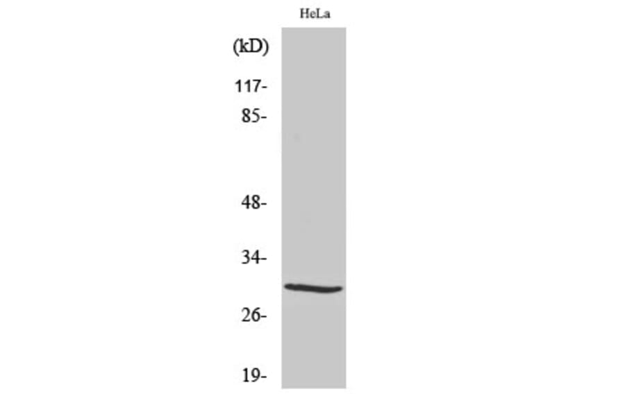 Western blot - Acrp30 Polyclonal Antibody from Signalway Antibody (40546) - Antibodies.com