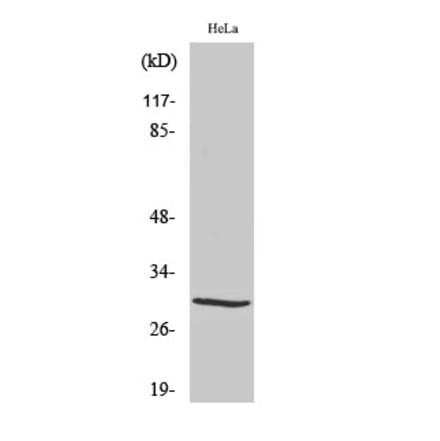 Western blot - Acrp30 Polyclonal Antibody from Signalway Antibody (40546) - Antibodies.com