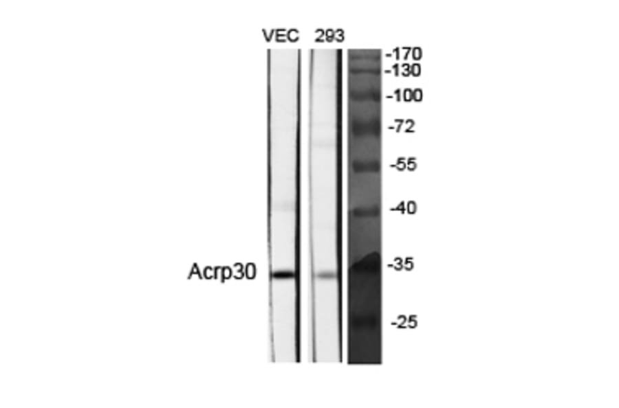 Western blot - Acrp30 Polyclonal Antibody from Signalway Antibody (40546) - Antibodies.com