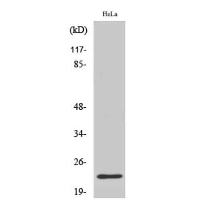 Western blot - CD179b Polyclonal Antibody from Signalway Antibody (40696) - Antibodies.com