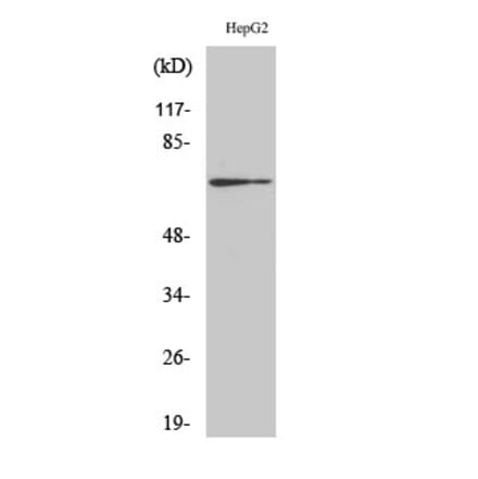 Western blot - Cdc25A Polyclonal Antibody from Signalway Antibody (40714) - Antibodies.com