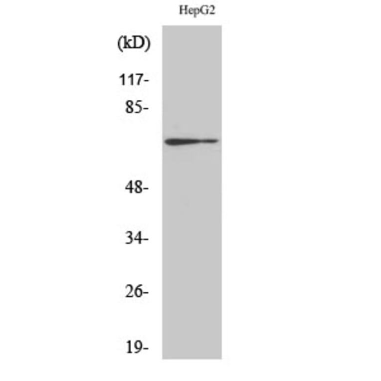 Western blot - Cdc25A Polyclonal Antibody from Signalway Antibody (40714) - Antibodies.com