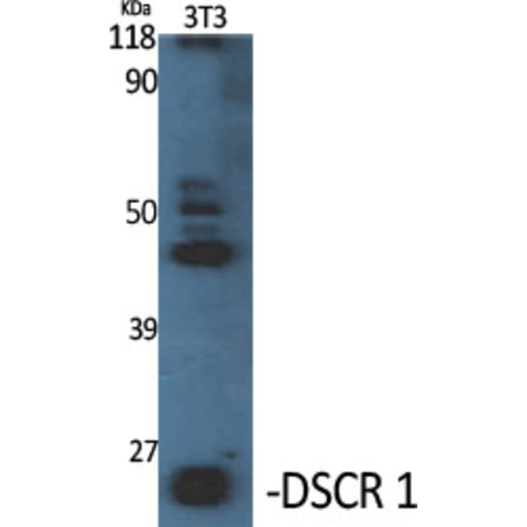 Western blot - DSCR 1 Polyclonal Antibody from Signalway Antibody (40854) - Antibodies.com