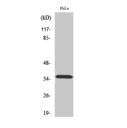 Western blot - ELOVL4 Polyclonal Antibody from Signalway Antibody (40878) - Antibodies.com