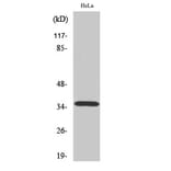 Western blot - ELOVL4 Polyclonal Antibody from Signalway Antibody (40878) - Antibodies.com