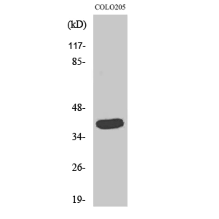Western blot - GATA-1 Polyclonal Antibody from Signalway Antibody (40953) - Antibodies.com