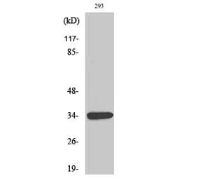 Western blot - GDF-15 Polyclonal Antibody from Signalway Antibody (40960) - Antibodies.com