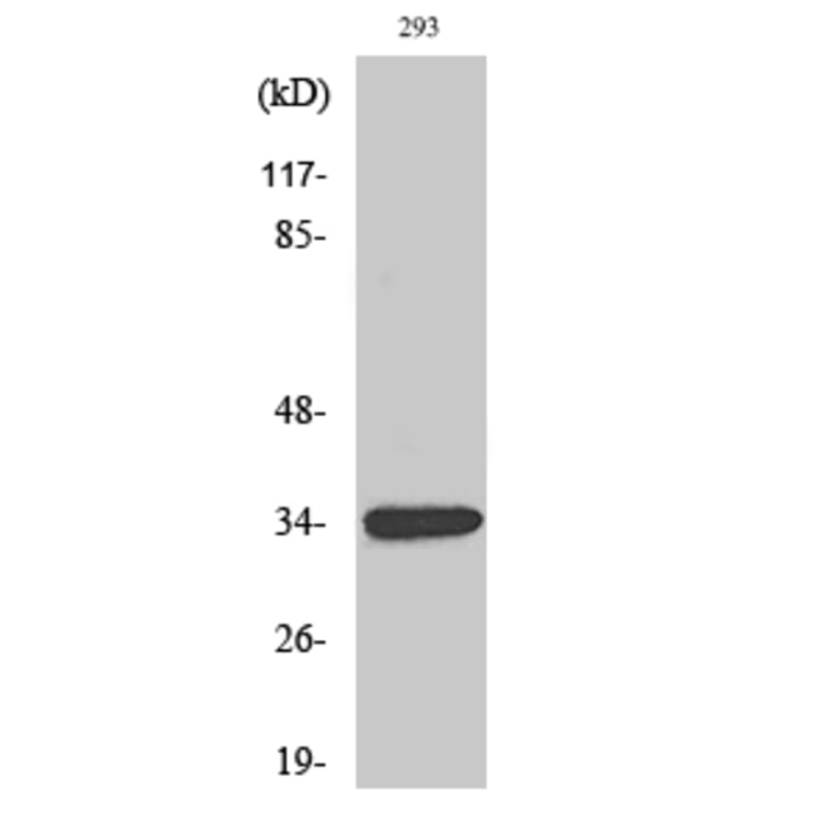 Western blot - GDF-15 Polyclonal Antibody from Signalway Antibody (40960) - Antibodies.com