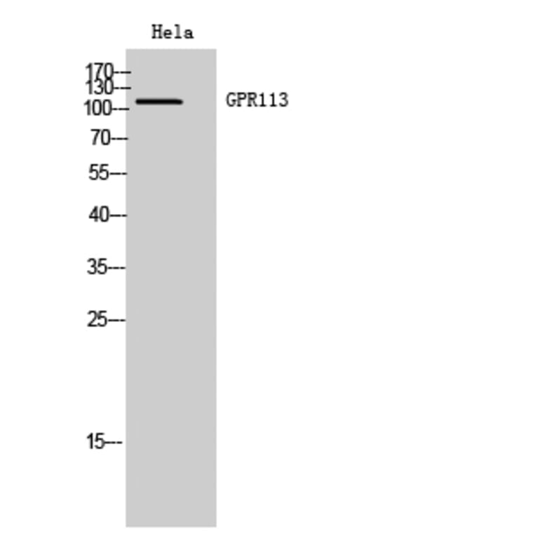 Western blot - GPR113 Polyclonal Antibody from Signalway Antibody (40971) - Antibodies.com