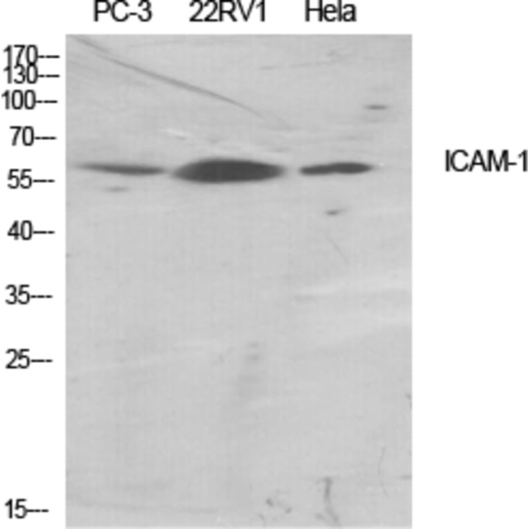 Western blot - ICAM-1 Polyclonal Antibody from Signalway Antibody (41050) - Antibodies.com