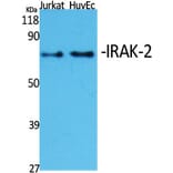 Western blot - IRAK-2 Polyclonal Antibody from Signalway Antibody (41073) - Antibodies.com