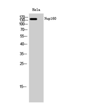 Western blot - Nup160 Polyclonal Antibody from Signalway Antibody (41259) - Antibodies.com