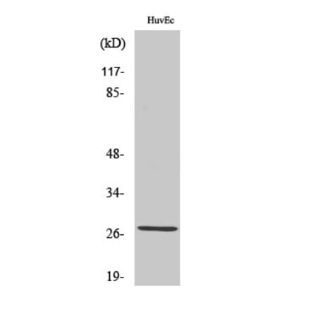 Western blot - PP32R1 Polyclonal Antibody from Signalway Antibody (41358) - Antibodies.com