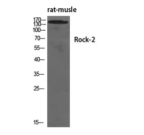 Western blot - Rock-2 Polyclonal Antibody from Signalway Antibody (41415) - Antibodies.com