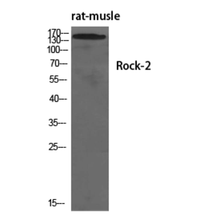 Western blot - Rock-2 Polyclonal Antibody from Signalway Antibody (41415) - Antibodies.com