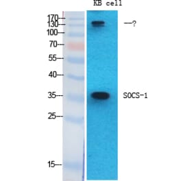Western blot - SOCS-1 Polyclonal Antibody from Signalway Antibody (41451) - Antibodies.com