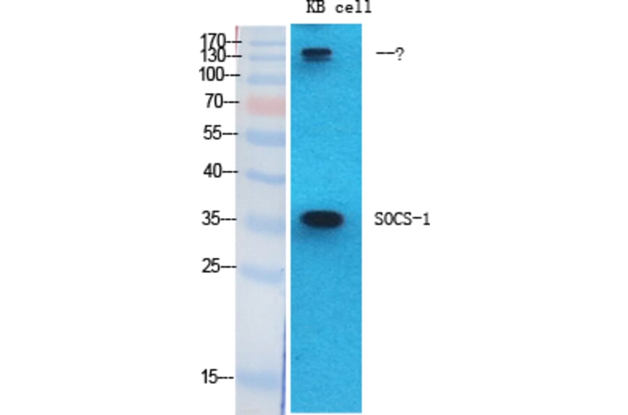 Western blot - SOCS-1 Polyclonal Antibody from Signalway Antibody (41451) - Antibodies.com