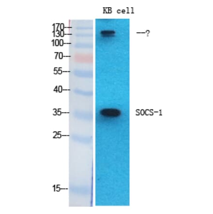Western blot - SOCS-1 Polyclonal Antibody from Signalway Antibody (41451) - Antibodies.com