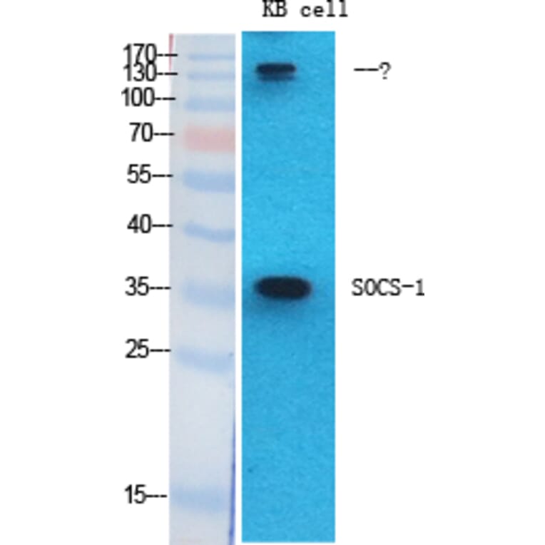 Western blot - SOCS-1 Polyclonal Antibody from Signalway Antibody (41451) - Antibodies.com