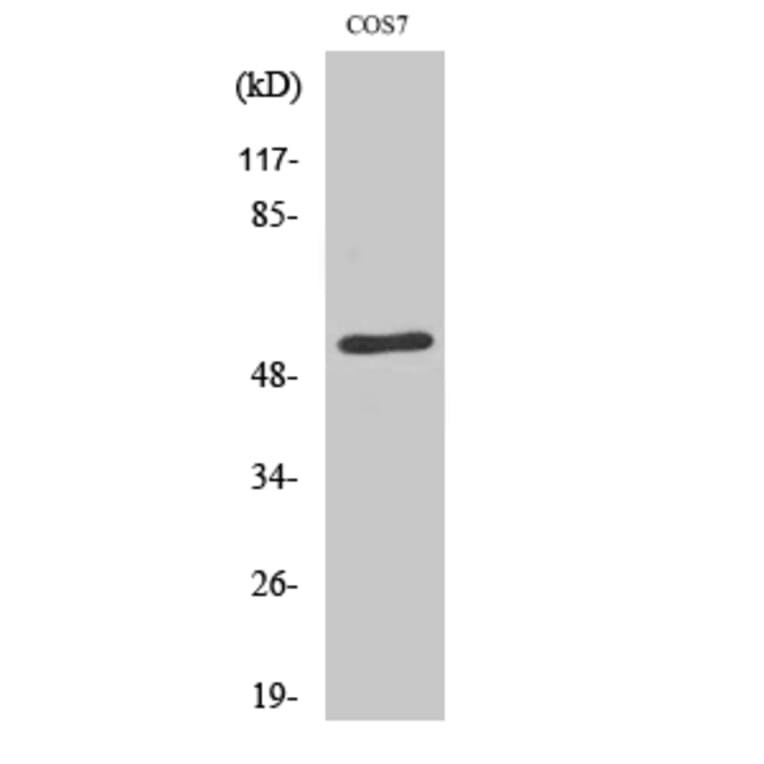 Western blot - TADA2L Polyclonal Antibody from Signalway Antibody (41476) - Antibodies.com