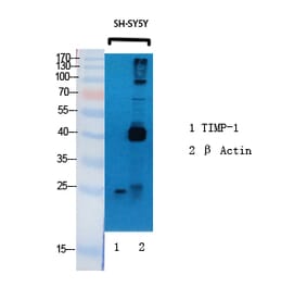 Western blot - TIMP-1 Polyclonal Antibody from Signalway Antibody (41499) - Antibodies.com