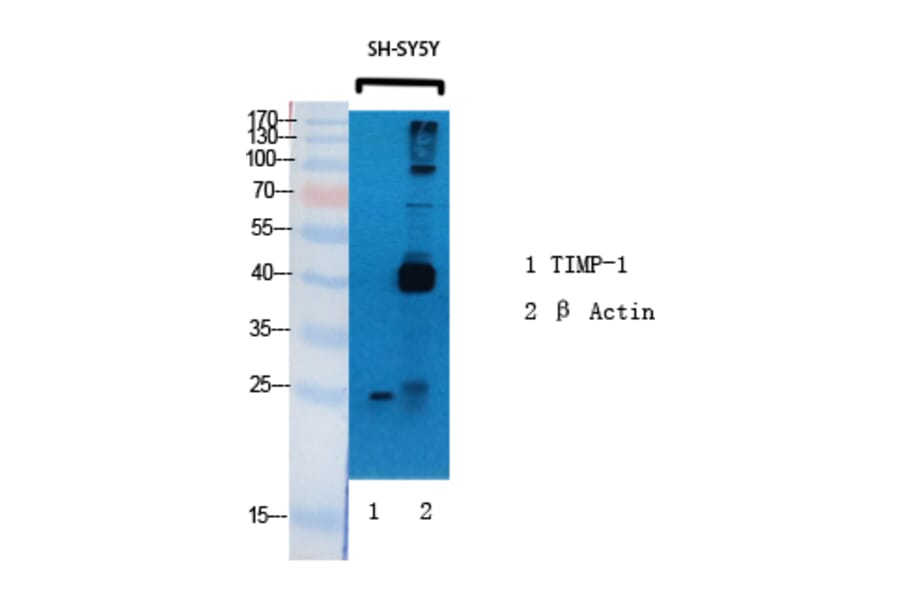 Western blot - TIMP-1 Polyclonal Antibody from Signalway Antibody (41499) - Antibodies.com