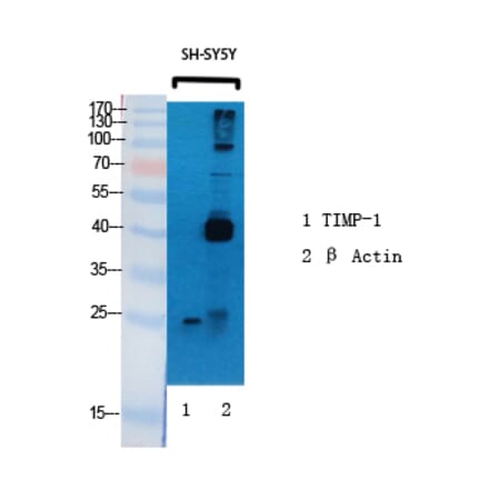 Western blot - TIMP-1 Polyclonal Antibody from Signalway Antibody (41499) - Antibodies.com
