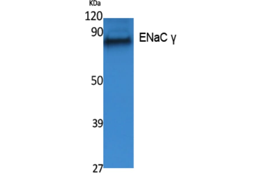 Western blot - ENaC γ Polyclonal Antibody from Signalway Antibody (41547) - Antibodies.com