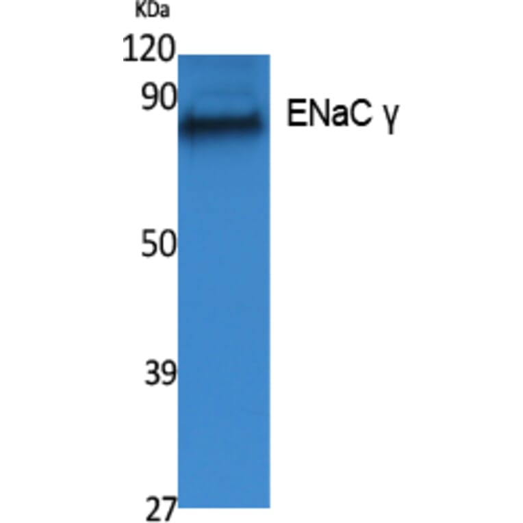 Western blot - ENaC γ Polyclonal Antibody from Signalway Antibody (41547) - Antibodies.com